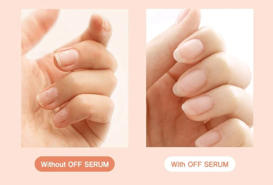 Gel Nail Remover Serum